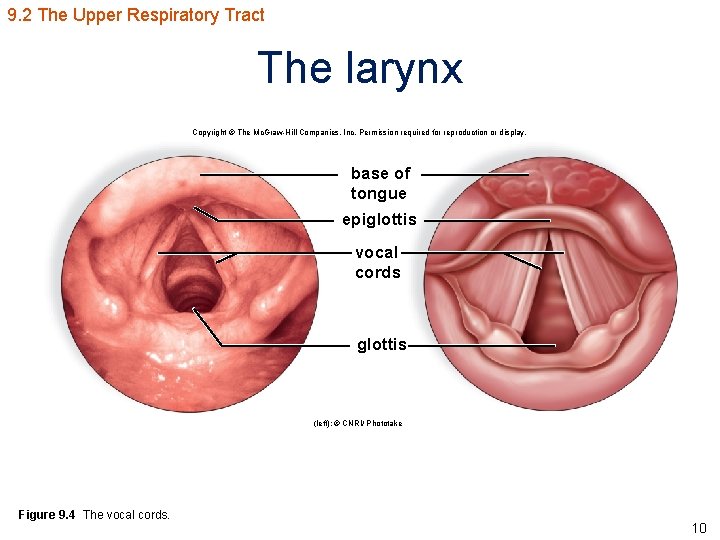 9. 2 The Upper Respiratory Tract The larynx Copyright © The Mc. Graw-Hill Companies,