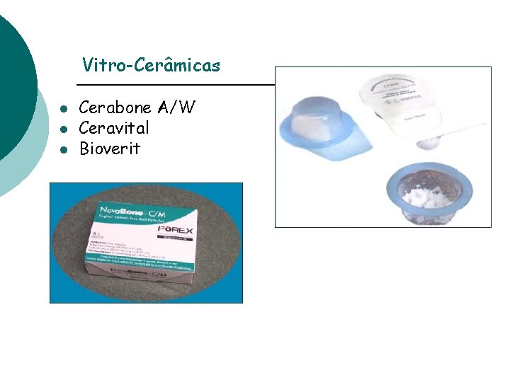 Vitro-Cerâmicas l l l Cerabone A/W Ceravital Bioverit 