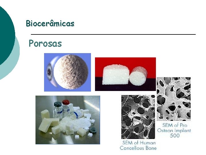 Biocerâmicas Porosas 