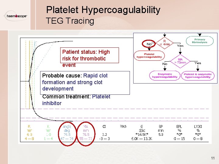 Platelet Hypercoagulability TEG Tracing Patient status: High risk for thrombotic event Probable cause: Rapid Platelet Hypercoagulability TEG Tracing Patient status: High risk for thrombotic event Probable cause: Rapid