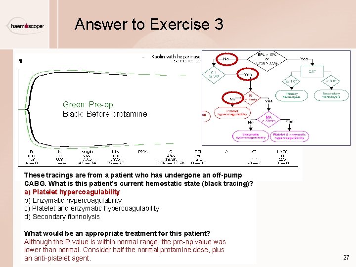 Answer to Exercise 3 Kaolin with heparinase Green: Pre-op Black: Before protamine These tracings Answer to Exercise 3 Kaolin with heparinase Green: Pre-op Black: Before protamine These tracings