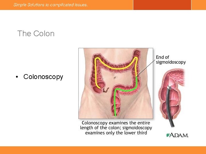 The Colon • Colonoscopy 