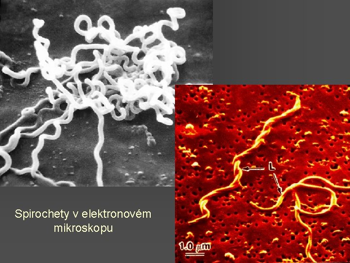 Spirochety v elektronovém mikroskopu 