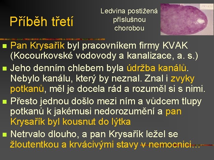 Příběh třetí n n Ledvina postižená příslušnou chorobou Pan Krysařík byl pracovníkem firmy KVAK