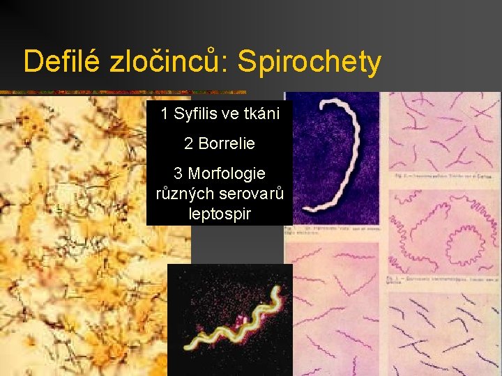 Defilé zločinců: Spirochety 1 Syfilis ve tkáni 2 Borrelie 3 Morfologie různých serovarů leptospir