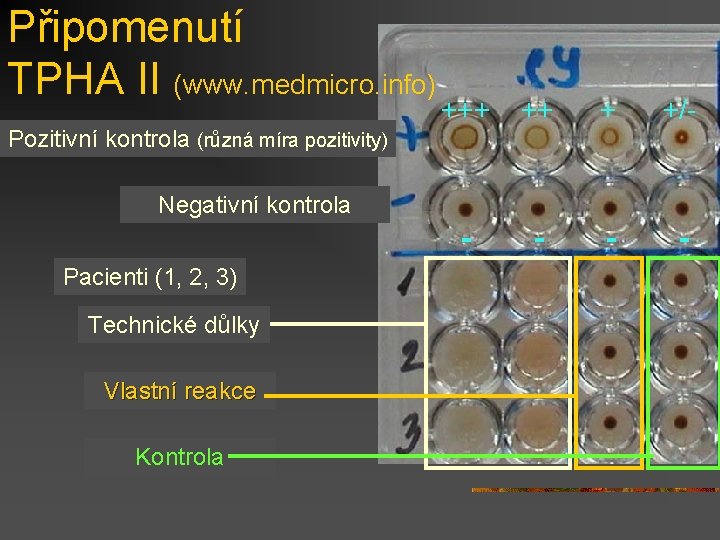 Připomenutí TPHA II (www. medmicro. info) Pozitivní kontrola (různá míra pozitivity) +++ ++ +