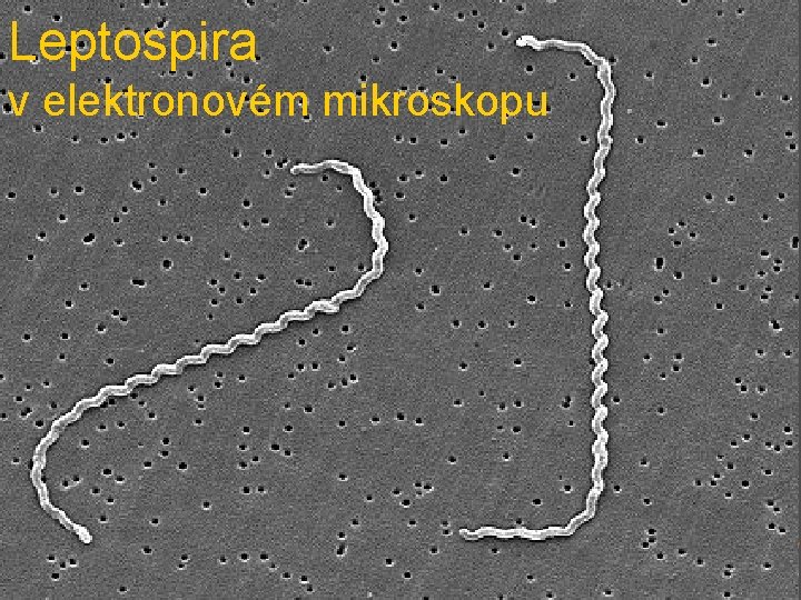 Leptospira v elektronovém mikroskopu 