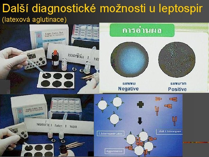 Další diagnostické možnosti u leptospir (latexová aglutinace) 