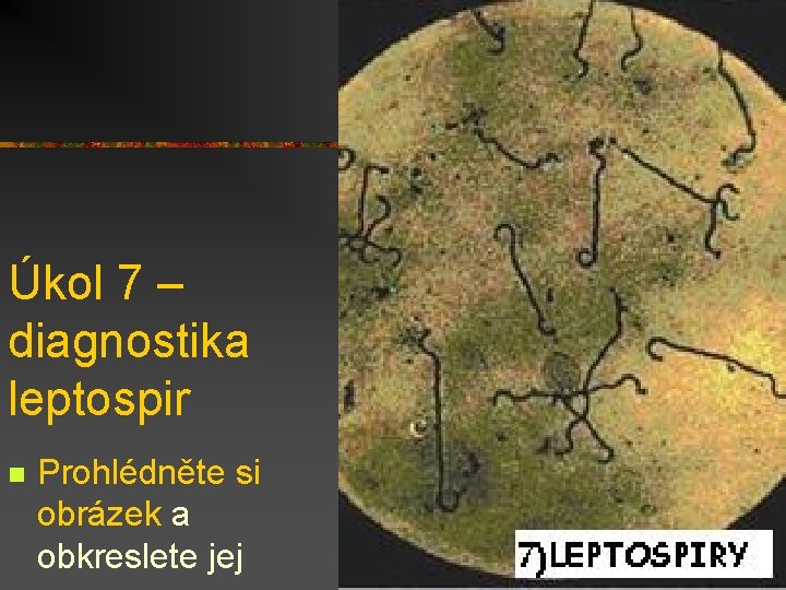 Úkol 7 – diagnostika leptospir n Prohlédněte si obrázek a obkreslete jej 