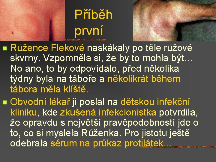 Příběh první n n Růžence Flekové naskákaly po těle růžové skvrny. Vzpomněla si, že