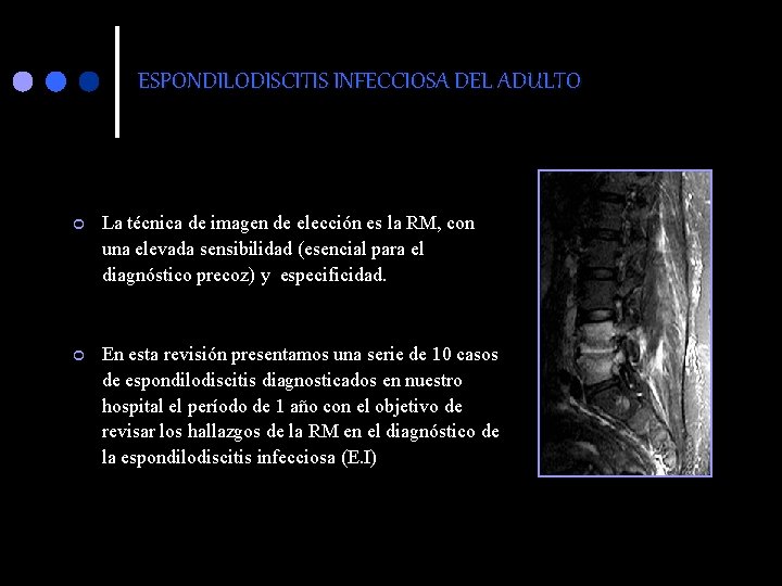 ESPONDILODISCITIS INFECCIOSA DEL ADULTO ¢ La técnica de imagen de elección es la RM,