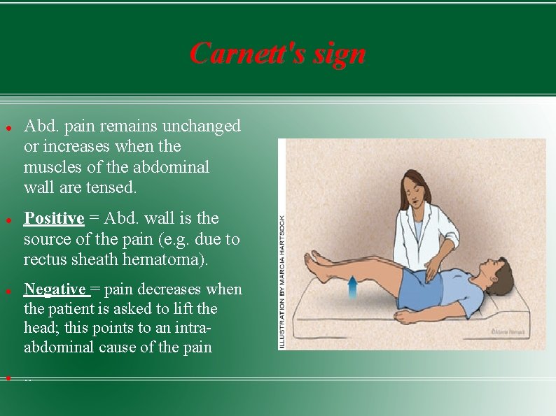 Carnett's sign Abd. pain remains unchanged or increases when the muscles of the abdominal