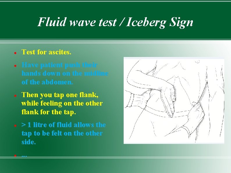 Fluid wave test / Iceberg Sign Test for ascites. Have patient push their hands