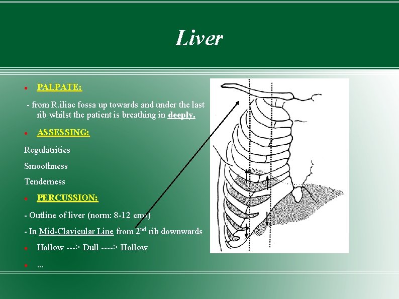 Liver PALPATE: - from R. iliac fossa up towards and under the last rib