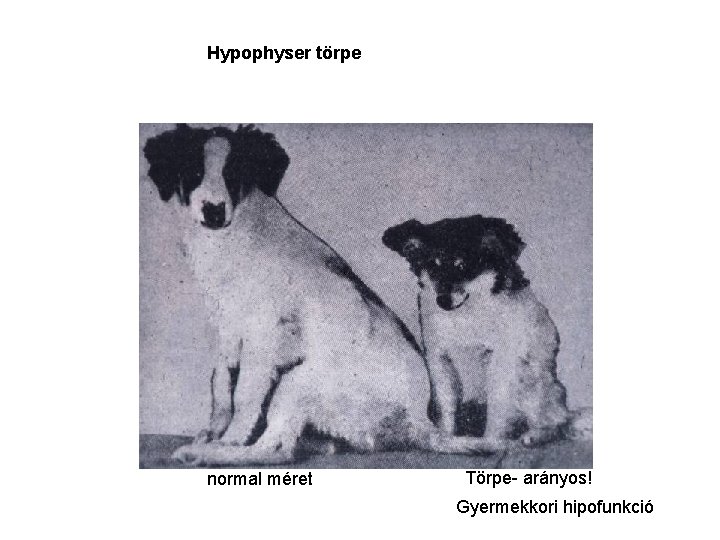 Hypophyser törpe normal méret Törpe- arányos! Gyermekkori hipofunkció 