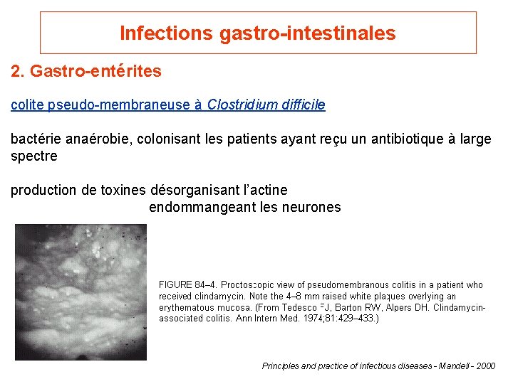 Infections gastro-intestinales 2. Gastro-entérites colite pseudo-membraneuse à Clostridium difficile bactérie anaérobie, colonisant les patients