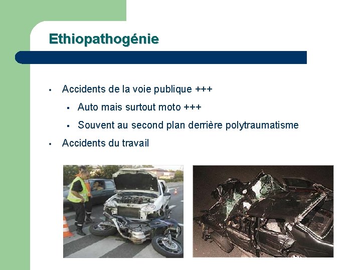 Ethiopathogénie • • Accidents de la voie publique +++ § Auto mais surtout moto