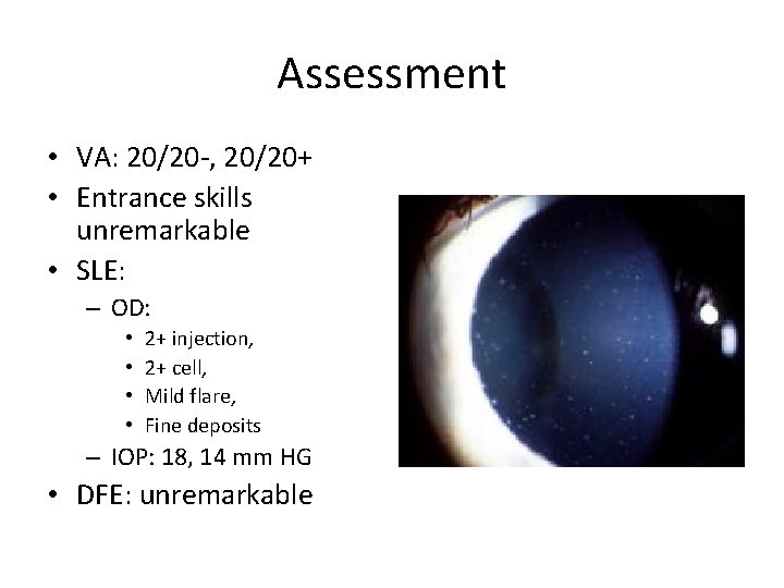 Assessment • VA: 20/20 -, 20/20+ • Entrance skills unremarkable • SLE: – OD: