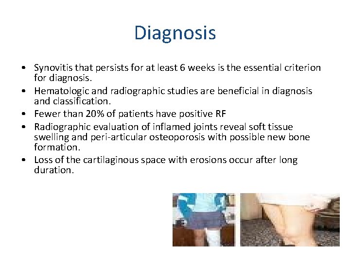 Diagnosis • Synovitis that persists for at least 6 weeks is the essential criterion