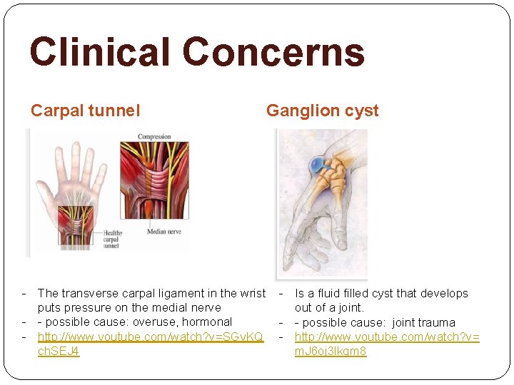 Clinical Concerns Carpal tunnel - The transverse carpal ligament in the wrist puts pressure
