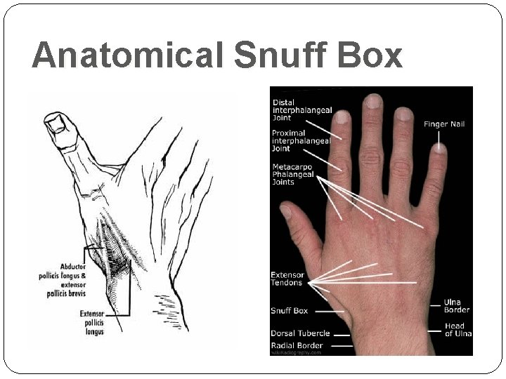 Anatomical Snuff Box 