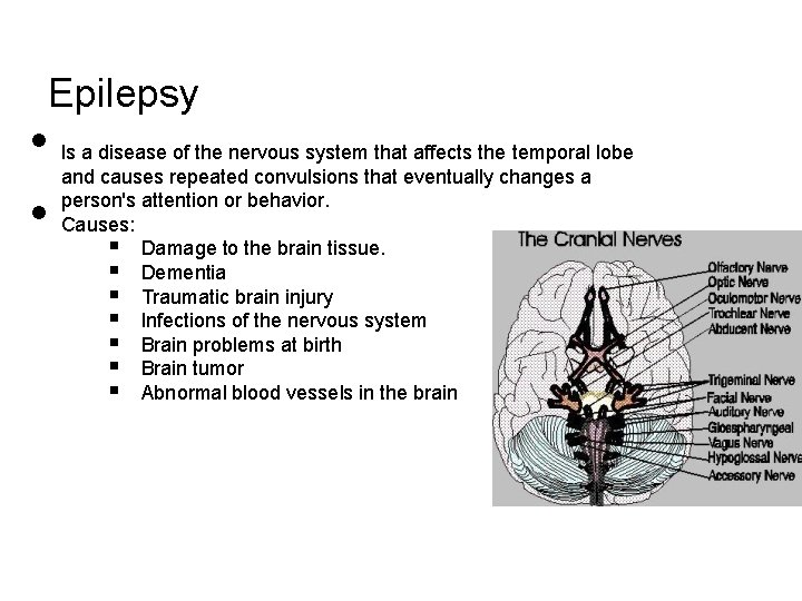 Epilepsy • • Is a disease of the nervous system that affects the temporal