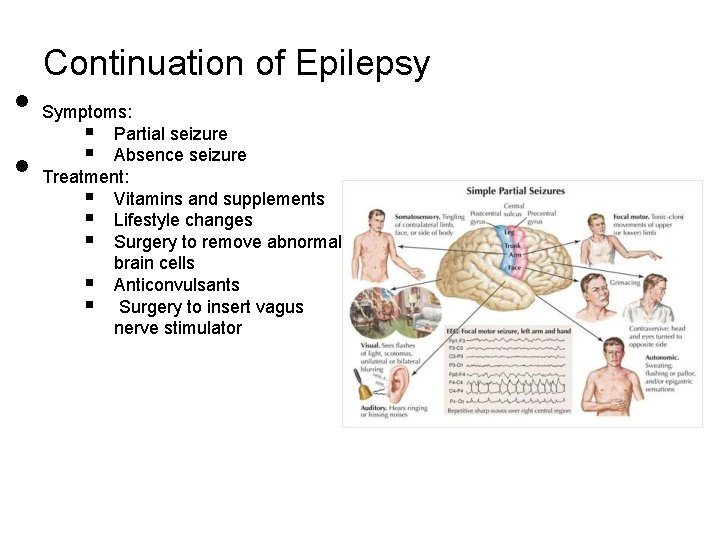  • • Continuation of Epilepsy Symptoms: § Partial seizure § Absence seizure Treatment: