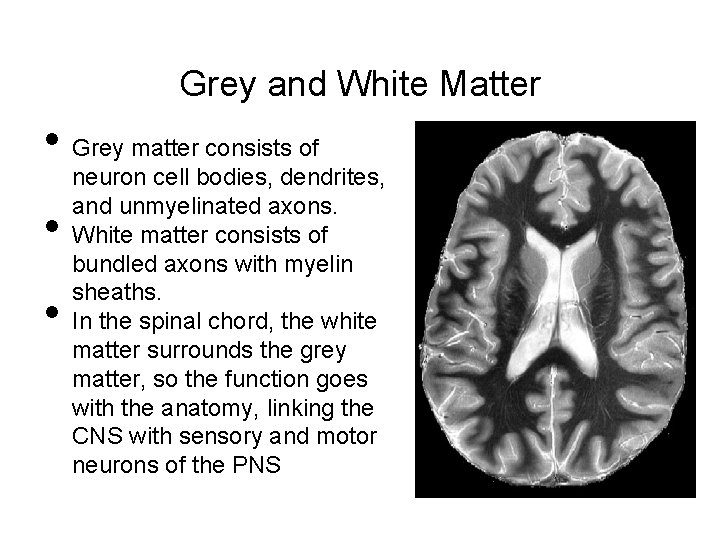 Grey and White Matter • Grey matter consists of • • neuron cell bodies,