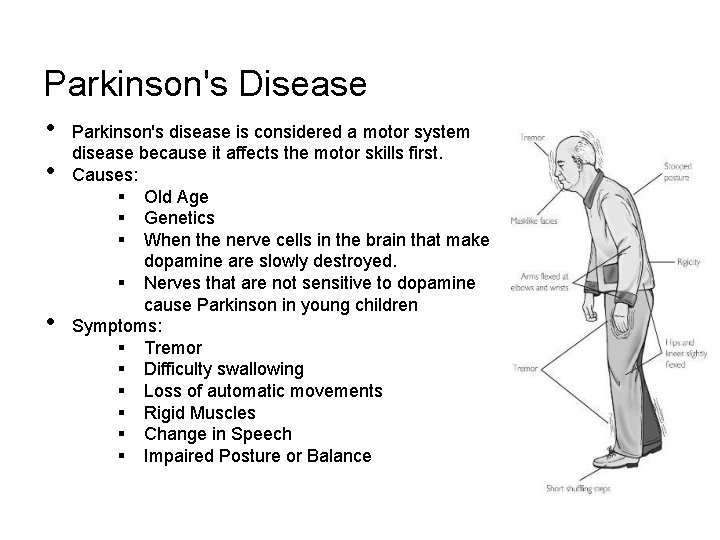 Parkinson's Disease • • • Parkinson's disease is considered a motor system disease because