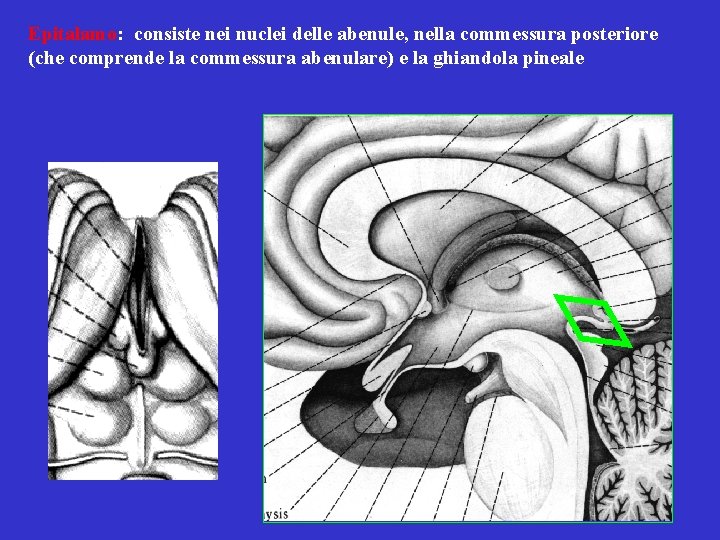 Epitalamo: consiste nei nuclei delle abenule, nella commessura posteriore (che comprende la commessura abenulare)