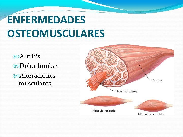 ENFERMEDADES OSTEOMUSCULARES Artritis Dolor lumbar Alteraciones musculares. 