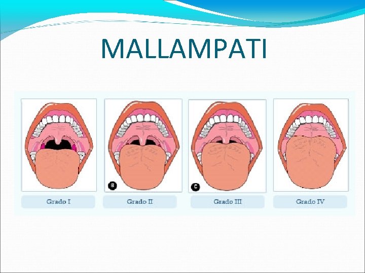 MALLAMPATI 