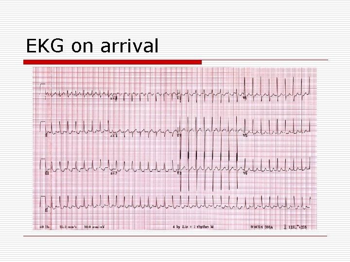 EKG on arrival 