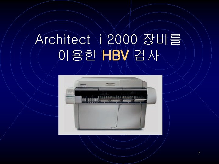 Architect i 2000 장비를 이용한 HBV 검사 7 