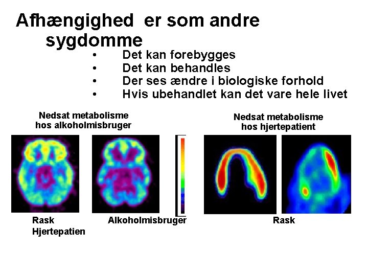 Afhængighed er som andre sygdomme • • Det kan forebygges Det kan behandles Der