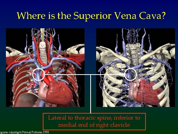 Where is the Superior Vena Cava? Lateral to thoracic spine, inferior to medial end