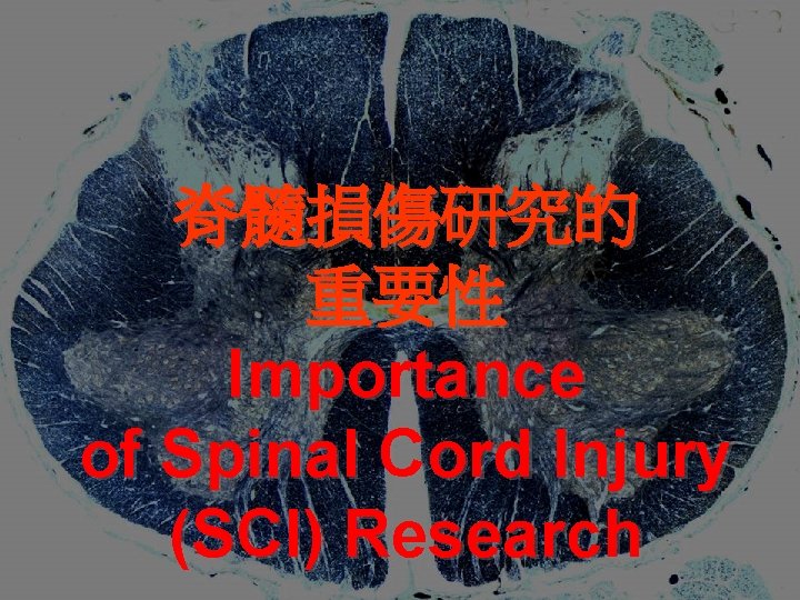 脊髓損傷研究的 重要性 Importance of Spinal Cord Injury (SCI) Research 