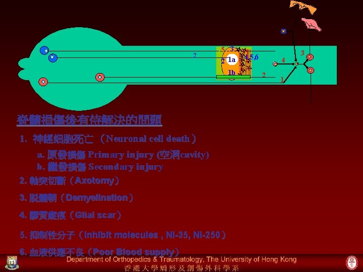 2 5 3 2 1 a 1 b 脊髓損傷後有侍解決的問題 1. 神經细胞死亡 （Neuronal cell death）