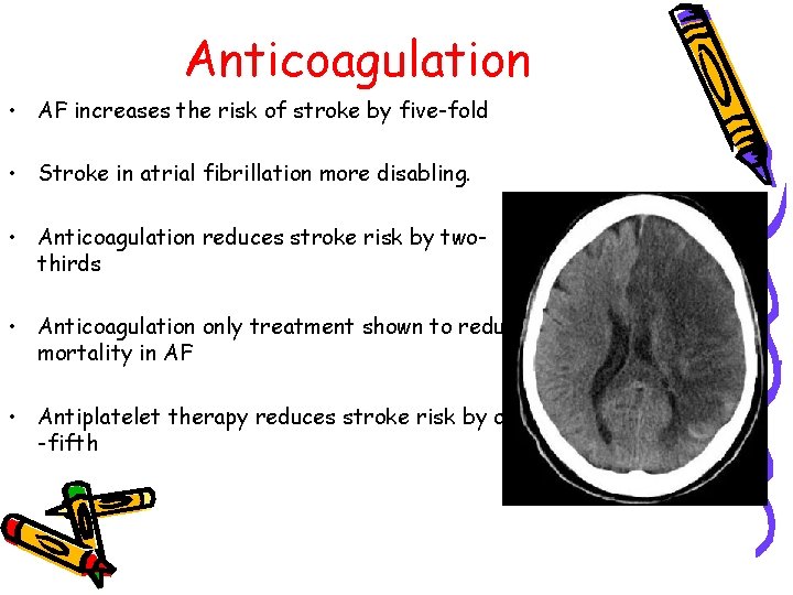 Anticoagulation • AF increases the risk of stroke by five-fold • Stroke in atrial