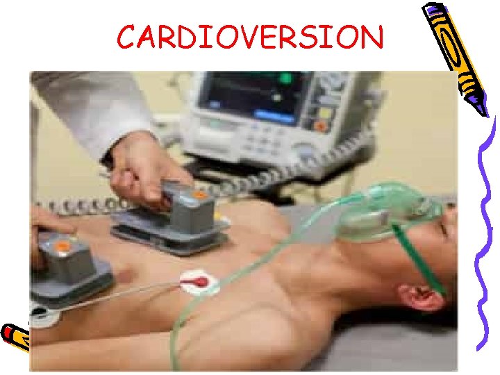 CARDIOVERSION 