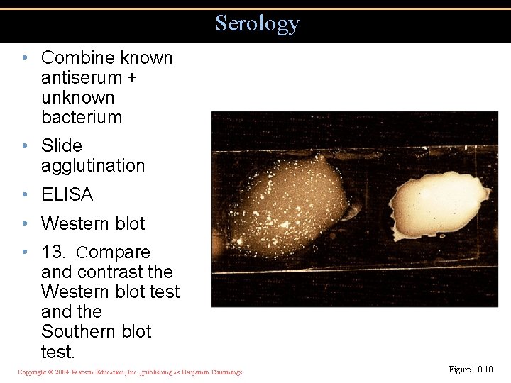 Serology • Combine known antiserum + unknown bacterium • Slide agglutination • ELISA •