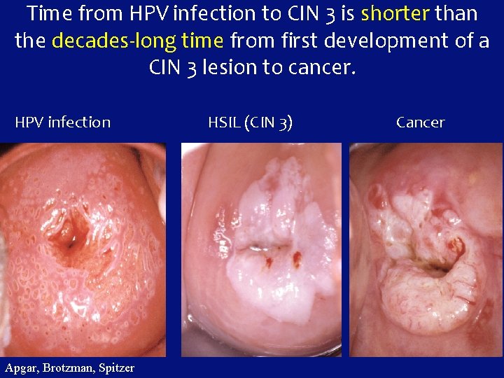 Time from HPV infection to CIN 3 is shorter than the decades-long time from