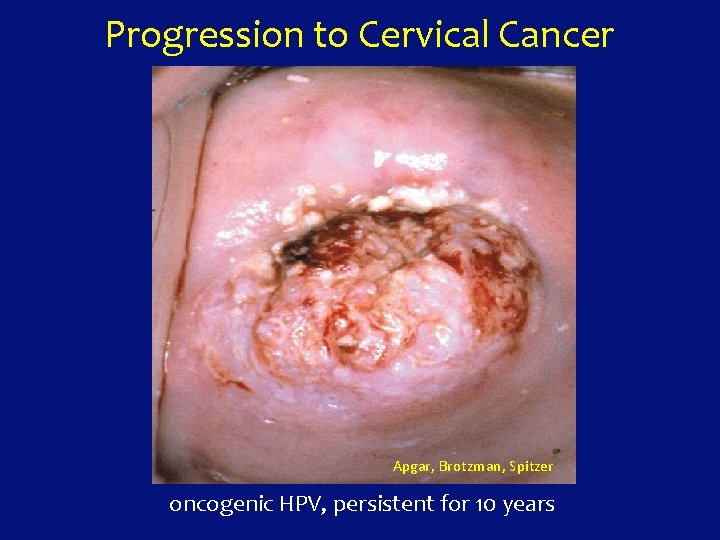 Progression to Cervical Cancer Apgar, Brotzman, Spitzer oncogenic HPV, persistent for 10 years 