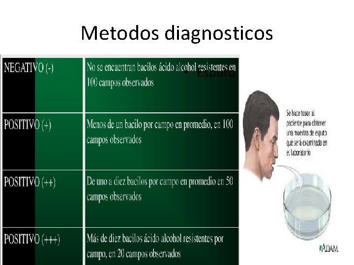 Metodos diagnosticos • Bacilos copia: 3 muestras en 2 días • Esputo 