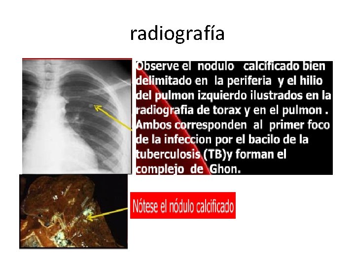 radiografía 