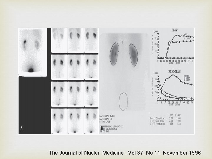  The Journal of Nucler Medicine. Vol 37. No 11. November 1996 
