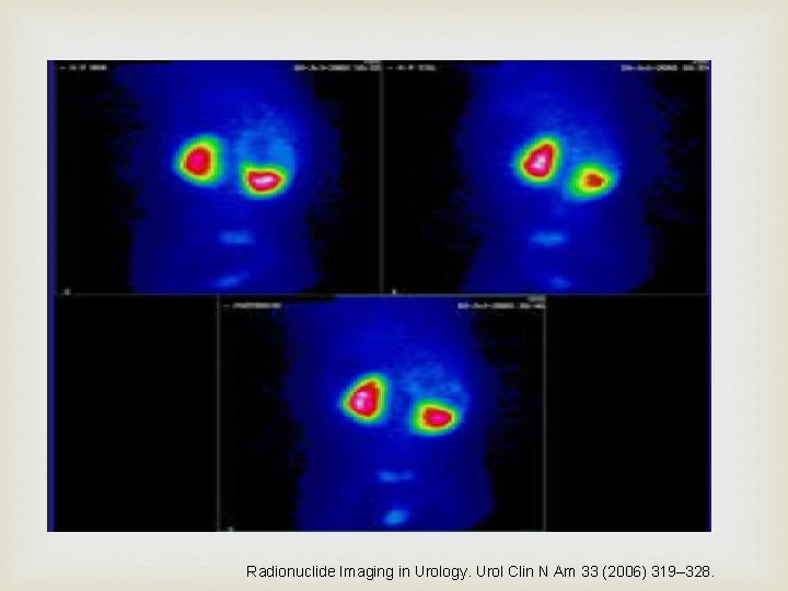  Radionuclide Imaging in Urology. Urol Clin N Am 33 (2006) 319– 328. 