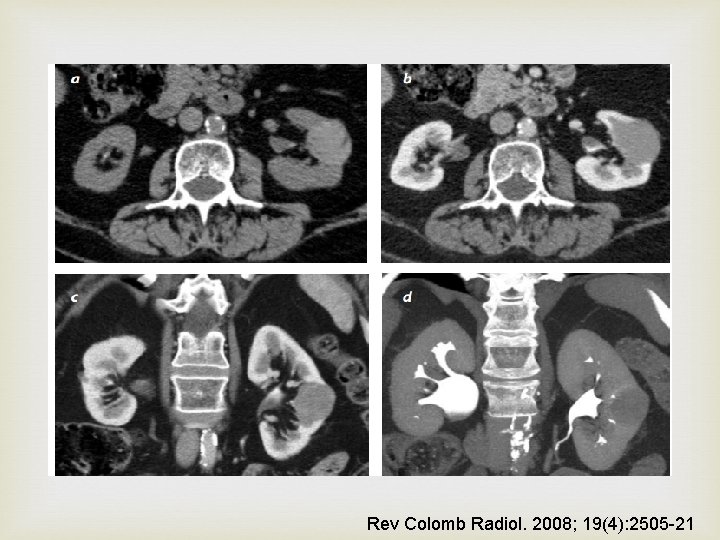  Rev Colomb Radiol. 2008; 19(4): 2505 -21 