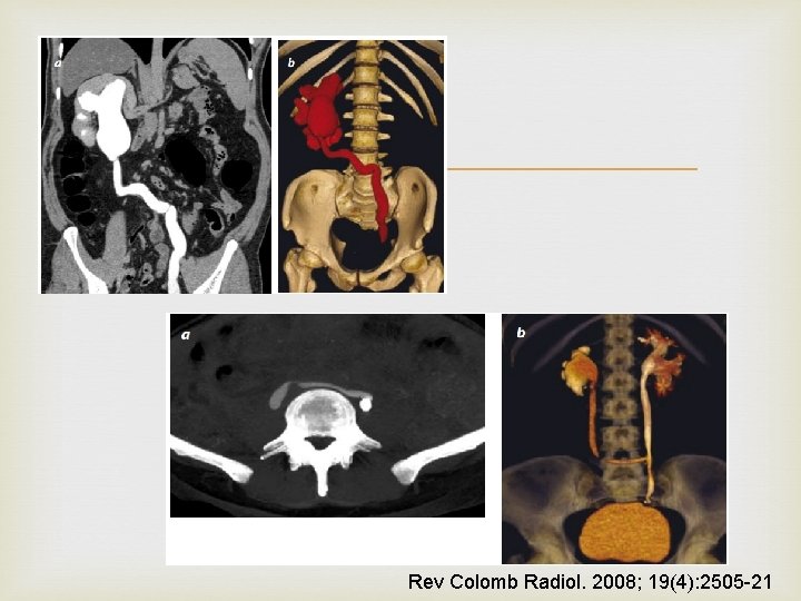  Rev Colomb Radiol. 2008; 19(4): 2505 -21 
