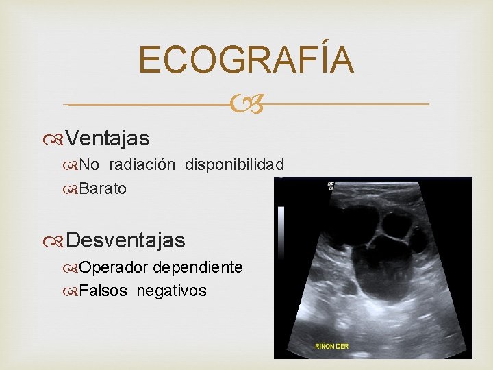 ECOGRAFÍA Ventajas No radiación disponibilidad Barato Desventajas Operador dependiente Falsos negativos 